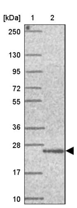 Invitrogen UBALD1 Polyclonal Antibody 100 &mu;L | Buy Online | Invitrogen&trade; | Fisher Scientific