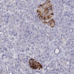 Invitrogen TMEM211 Polyclonal Antibody 100 &mu;L; Unconjugated:Antibodies,