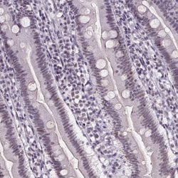 Invitrogen ZNF572 Polyclonal Antibody 100 &mu;L; Unconjugated:Antibodies,