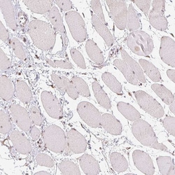 Invitrogen RAB22A Polyclonal Antibody 100 &mu;L; Unconjugated:Antibodies,