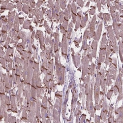 Invitrogen COMMD4 Polyclonal Antibody 100 &mu;L; Unconjugated:Antibodies,