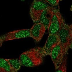 Invitrogen BTF3L4 Polyclonal Antibody 100 &mu;L; Unconjugated:Antibodies,
