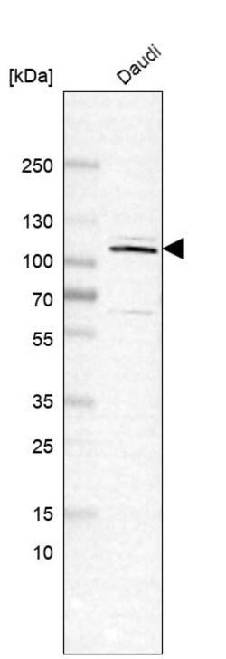 Invitrogen Importin 11 Polyclonal Antibody 100 &mu;L; Unconjugated:Antibodies,