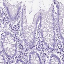 Invitrogen DNAH2 Polyclonal Antibody 100 &mu;L; Unconjugated:Antibodies,