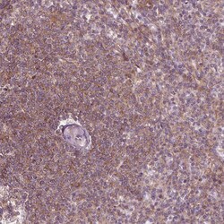 Invitrogen ADAM33 Polyclonal Antibody 100 &mu;L | Buy Online | Invitrogen&trade; | Fisher Scientific