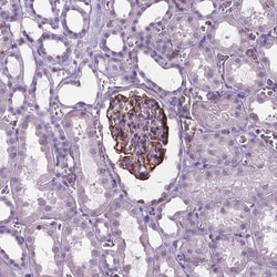Invitrogen AMOT Polyclonal Antibody 100 &mu;L; Unconjugated:Antibodies,