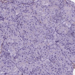Invitrogen AMOT Polyclonal Antibody 100 &mu;L; Unconjugated:Antibodies,