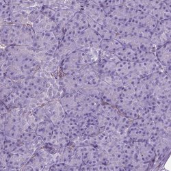 Invitrogen AMOT Polyclonal Antibody 100 &mu;L; Unconjugated:Antibodies,