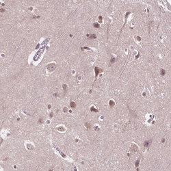 Invitrogen ISLR2 Polyclonal Antibody 100 &mu;L; Unconjugated:Antibodies,
