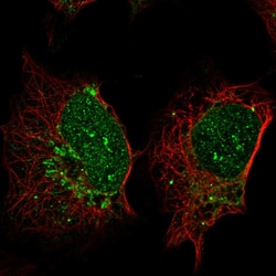 Invitrogen SP140 Polyclonal Antibody 100 &mu;L; Unconjugated:Antibodies,