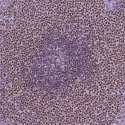 Invitrogen SP140 Polyclonal Antibody 100 &mu;L; Unconjugated:Antibodies,