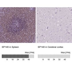 Invitrogen SP140 Polyclonal Antibody 100 &mu;L; Unconjugated:Antibodies,