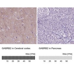 Invitrogen GABRB2 Polyclonal Antibody 100 &mu;L; Unconjugated:Antibodies,