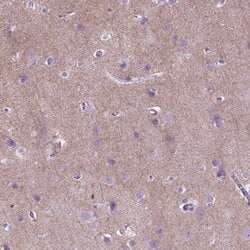 Invitrogen GABRB2 Polyclonal Antibody 100 &mu;L; Unconjugated:Antibodies,