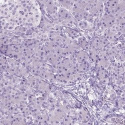 Invitrogen GABRB2 Polyclonal Antibody 100 &mu;L; Unconjugated:Antibodies,