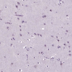 Invitrogen ZNF853 Polyclonal Antibody 100 &mu;L; Unconjugated:Antibodies,