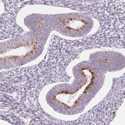 Invitrogen&trade;&nbsp;SAMD5 Polyclonal Antibody