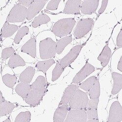 Invitrogen&trade;&nbsp;SAMD5 Polyclonal Antibody