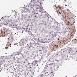 Invitrogen&trade;&nbsp;SAMD5 Polyclonal Antibody