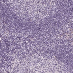 Invitrogen&trade;&nbsp;SAMD5 Polyclonal Antibody