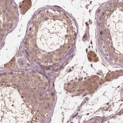 Invitrogen GJA9 Polyclonal Antibody 100 &mu;L; Unconjugated:Antibodies,