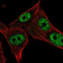 Invitrogen POLR3D Polyclonal Antibody 100 &mu;L; Unconjugated:Antibodies,