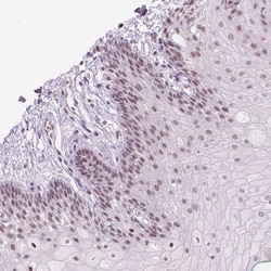Invitrogen POLR3D Polyclonal Antibody 100 &mu;L; Unconjugated:Antibodies,