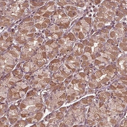 Invitrogen CDKL4 Polyclonal Antibody 100 &mu;L; Unconjugated:Antibodies,