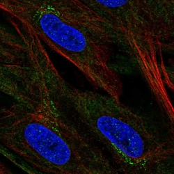 Invitrogen CCDC71L Polyclonal Antibody 100 &mu;L; Unconjugated:Antibodies,