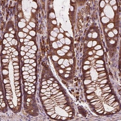 Invitrogen CCDC71L Polyclonal Antibody 100 &mu;L; Unconjugated:Antibodies,