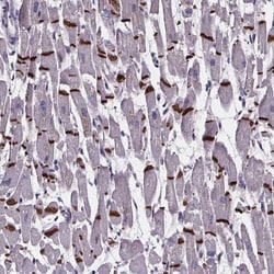 Invitrogen RD3L Polyclonal Antibody 100 &mu;L; Unconjugated:Antibodies,