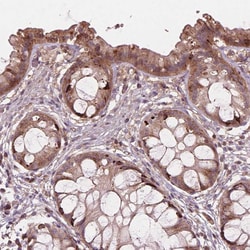 Invitrogen FNIP1 Polyclonal Antibody 100 &mu;L; Unconjugated:Antibodies,