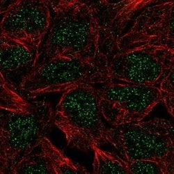 Invitrogen CTR9 Polyclonal Antibody 100 &mu;L; Unconjugated:Antibodies,