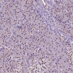 Invitrogen CTR9 Polyclonal Antibody 100 &mu;L; Unconjugated:Antibodies,