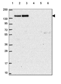 Invitrogen CTR9 Polyclonal Antibody 100 &mu;L; Unconjugated:Antibodies,