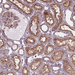 Invitrogen DMWD Polyclonal Antibody 100 &mu;L; Unconjugated:Antibodies,