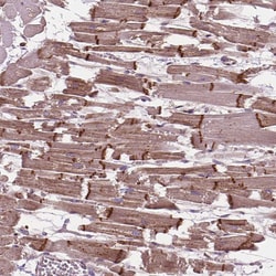 Invitrogen CHMP4A Polyclonal Antibody 100 &mu;L; Unconjugated:Antibodies,