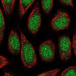 Invitrogen ZNF879 Polyclonal Antibody 100 &mu;L; Unconjugated:Antibodies,