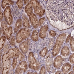Invitrogen ZNF879 Polyclonal Antibody 100 &mu;L; Unconjugated:Antibodies,