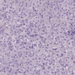 Invitrogen PHGR1 Polyclonal Antibody 100 &mu;L; Unconjugated:Antibodies,