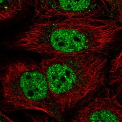 Invitrogen KIAA0040 Polyclonal Antibody 100 &mu;L; Unconjugated:Antibodies,
