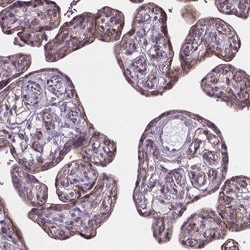Invitrogen KIAA0040 Polyclonal Antibody 100 &mu;L; Unconjugated:Antibodies,