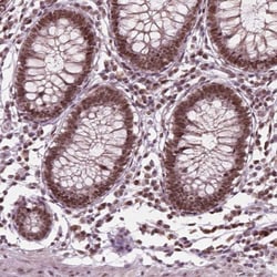 Invitrogen POLR2E Polyclonal Antibody 100 &mu;L; Unconjugated:Antibodies,