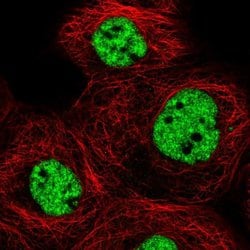Invitrogen MED6 Polyclonal Antibody 100 &mu;L | Buy Online | Invitrogen&trade; | Fisher Scientific