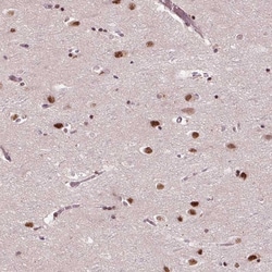 Invitrogen MED6 Polyclonal Antibody 100 &mu;L | Buy Online | Invitrogen&trade; | Fisher Scientific
