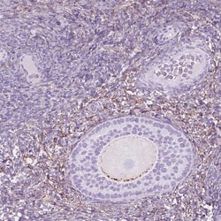 Invitrogen GDF9 Polyclonal Antibody 100 &mu;L; Unconjugated:Antibodies,