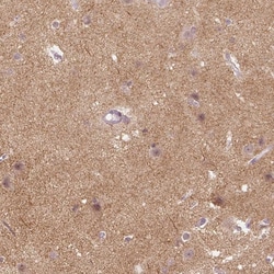 Invitrogen Neuroligin 2 Polyclonal Antibody 100 &mu;L; Unconjugated:Antibodies,