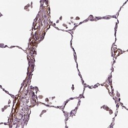 Invitrogen PTX3 Polyclonal Antibody 100 &mu;L; Unconjugated:Antibodies,
