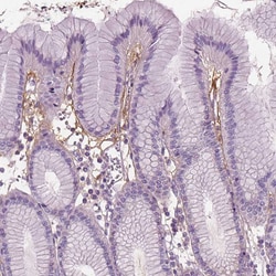Invitrogen PTX3 Polyclonal Antibody 100 &mu;L; Unconjugated:Antibodies,