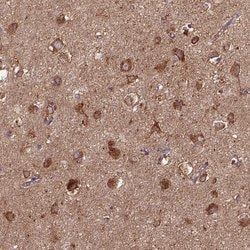 Invitrogen MTCO1 Polyclonal Antibody 100 &mu;L; Unconjugated:Antibodies,
